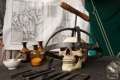 Qué hacía que los incas fueran tan brillantes en cirugía craneal