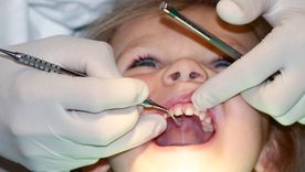 La fluoración del agua ha tenido un impacto particularmente visible en la salud dental de los niños en zonas con dificultad de acceso a crema de dientes con flúor. La fluoración del agua ha tenido un impacto particularmente visible en la salud dental de los niños en zonas con dificultad de acceso a crema de dientes con flúor.