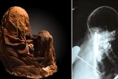 Momia hallada en el volcán de Ampato (Perú) y su radiografía. Foto: Universidad Católica de Santa María