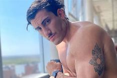 el retoque estetico que tomas holder, ex gran hermano, se hizo en su rostro