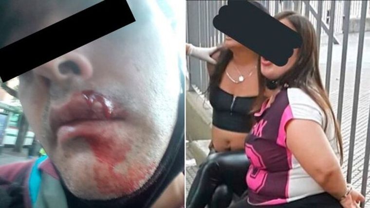 De piedras tirar Así quedó el rostro del efectivo tras recibir el cascotazo.