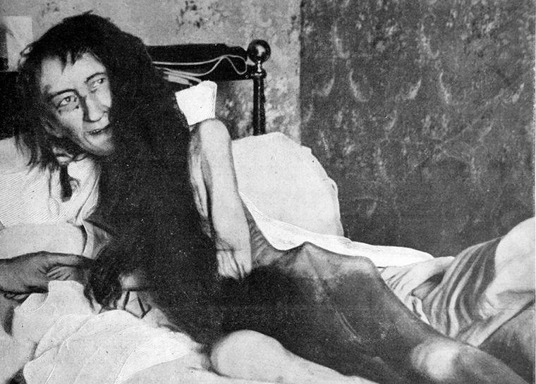 Macabro Blanche a poco de ser rescatada. Había sido bella.