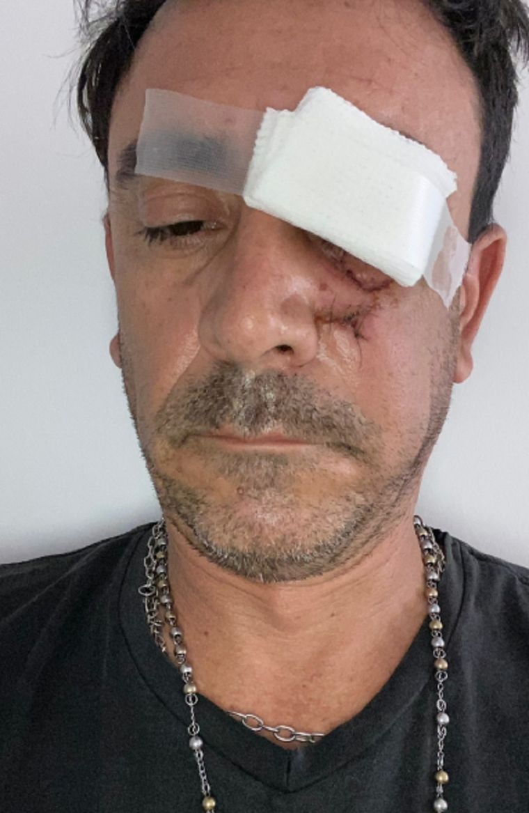 Así quedó la víctima tras la agresión