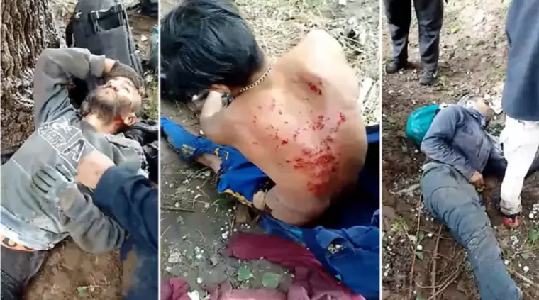 Las secuelas que les dejó el rayo a tres de las víctimas. Foto: gentileza.