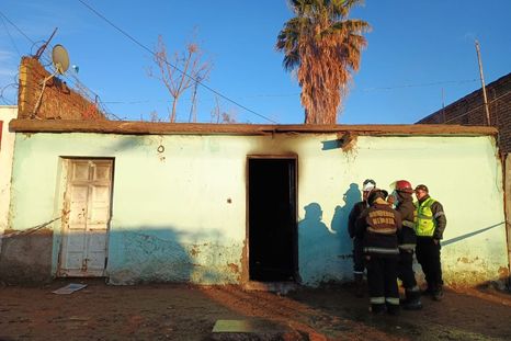 se le incendio la casa y termino con mas del 70% del cuerpo quemado se le incendio la casa y termino con mas del 70% del cuerpo quemado