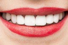 tener dientes super blancos es peligroso