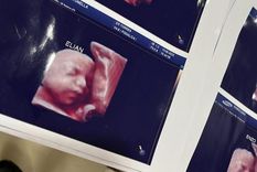 Hasta el momento hay al menos cuatro mamás que dijeron que habían recibido la misma foto para su ecografía 5D Foto: Twitter @RoglanAntonella