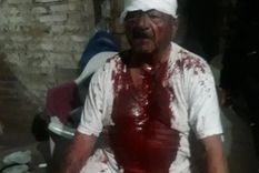 El jubilado terminó con graves heridas en la cabeza y en sus brazos
