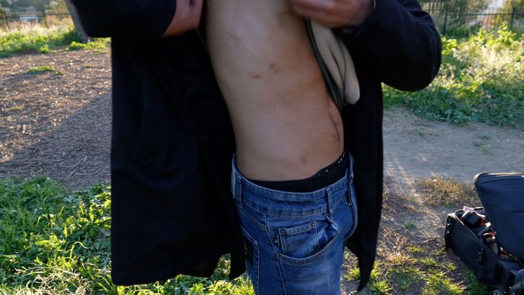 El Inmortal, miembro de una pandilla de Marsella, muestra sus heridas de bala en un ataque de una pandilla rival.