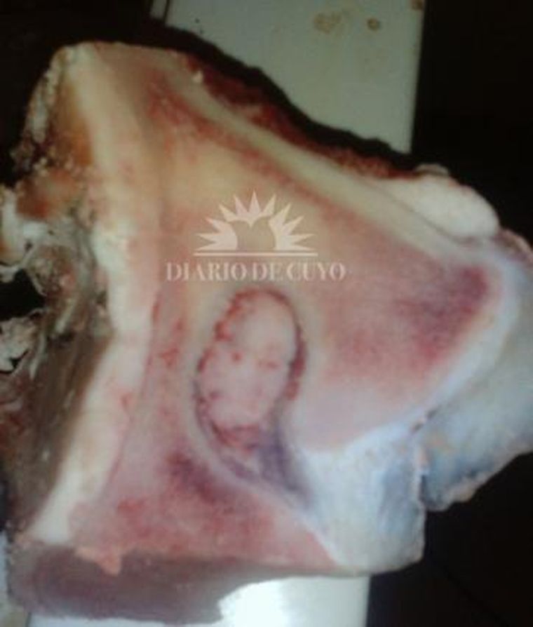 Foto: Diario de Cuyo