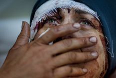 Foto: AP / Rodrigo Abd