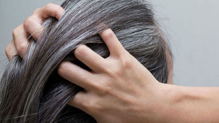 ¿Quieres evitar las canas? estos son los alimentos que debes incluir en tus dietas para lograrlo con éxito Foto: Archivo