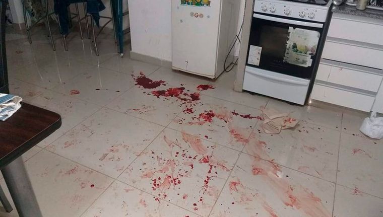 La mujer fue golpeada con un elemento contundente por su pareja que se suicidó/Imagen Ilustrativa Foto: Archivo