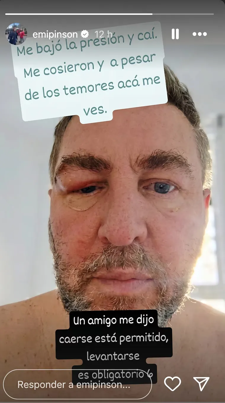 El accidente de Pinsón. El accidente de Pinsón.