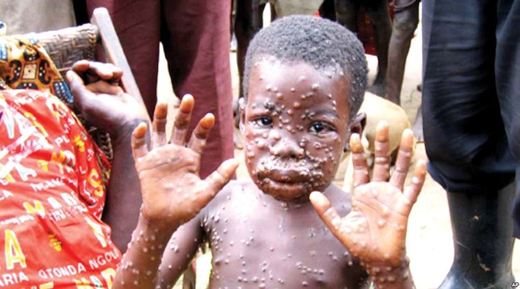 Foto: TheGuardianNigeria.