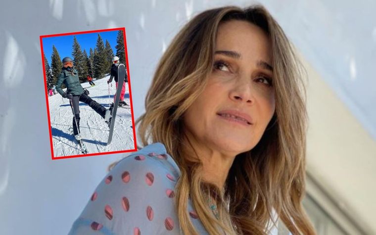 En reahabilitación Lozano mostró un nuevo avance: cómo quedaron sus pies.