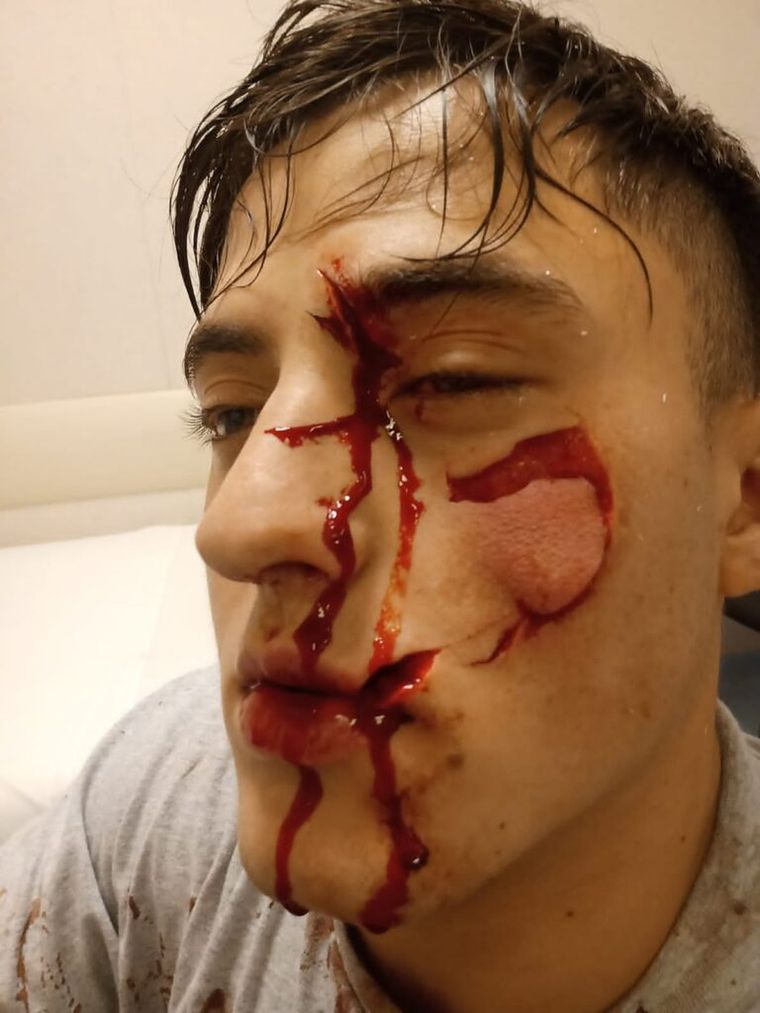 Así quedó el joven tras la brutal agresión