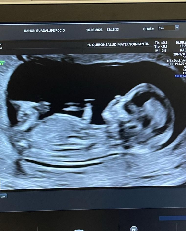 En Argentina, 43.210 adolescentes de entre 15 y 19 años tuvieron un hijo o hija en 2022 Foto: Instagram Wadaramon.