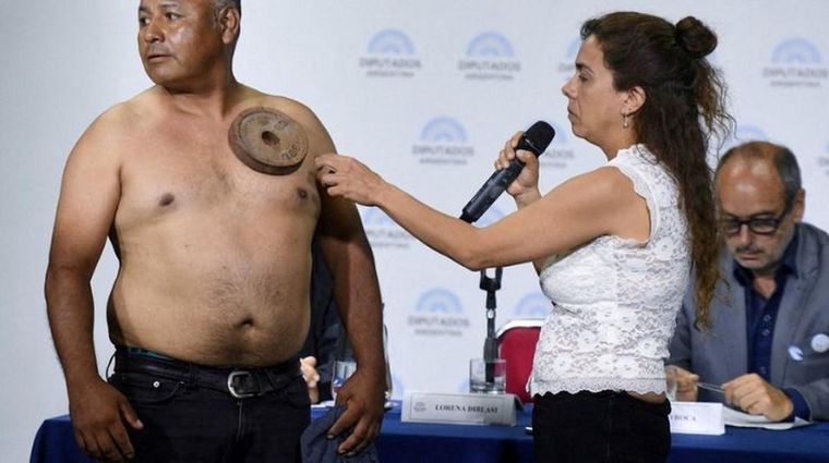 Luego de haber generado polémica en la jornada anti vacunas realizada en el Congreso, José Daniel Fabián relató cómo se dio cuenta de su magnetismo..