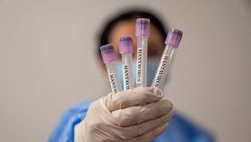 No tiene nada que ver con la covid, el hantavirus tiene escasa capacidad para producir epidemias o una pandemia