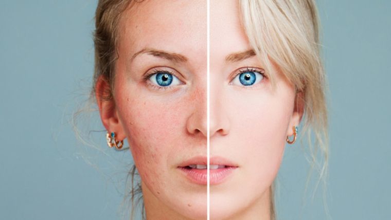 Foto: Canales MAPFRE