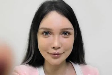 MDZol | Abby Wu, que se ha sometido a más de 100 operaciones, es una de las primeras influencers chinas en temas de cirugía estética. Foto: BBC