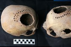 hace mil anos, ya hacian en peru cirugias cerebrales