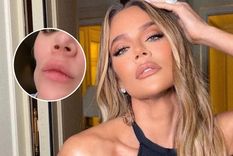 Khloé Kardashian mostró los cambios que sufrió su rostro tras operarse un tumor.