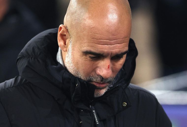 Guardiola terminó con la cara lastimada luego del partido del City. Foto: EFE