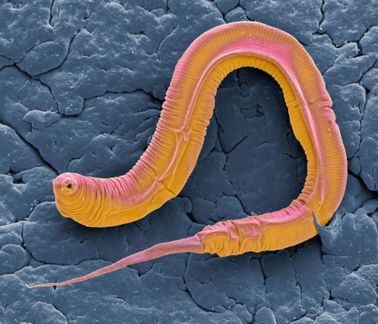 El Caenorhabditis elegans se utiliza a menudo para estudios relacionados con el envejecimiento. Foto: GETTY