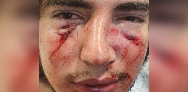 Así quedó Lautaro Insúa tras la paliza Foto: publicada en Olé