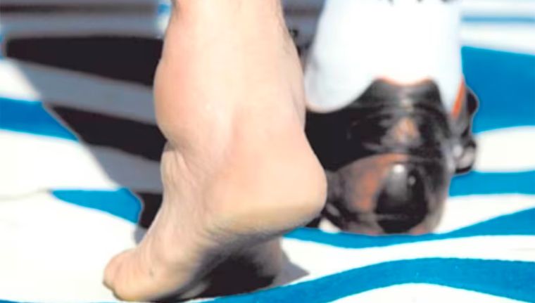 Esta foto corresponde al tobillo izquierdo de Juan Marcelo Ojeda, arquero de Deportivo Madryn y exjugador de Central y River. Y fue tomada en 2006, mucho después de Italia 90. Foto: archivo