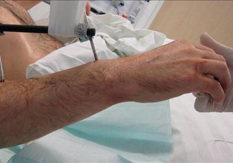 El paciente es un agricultor alemán de 54 años. Foto: EFE