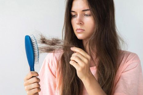 Caída del cabello. Caída del cabello.