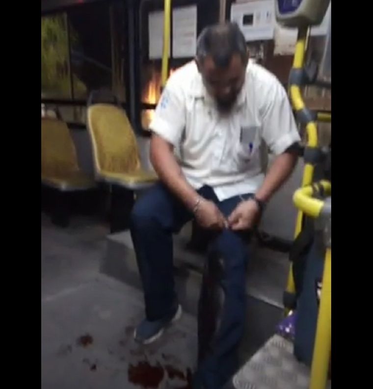 El colectivero debió realizarse un torniquete para disminuir la hemorragia