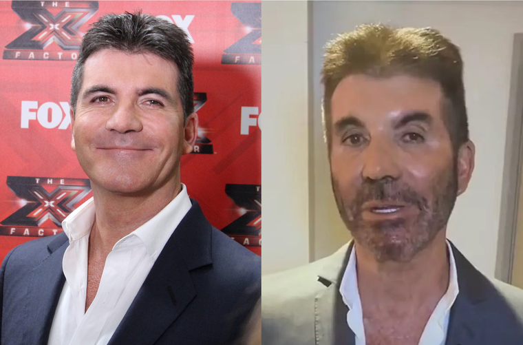El increíble cambio físico de Simon Cowell que dejó a todos sin palabras Simon Cowell Foto: Archivo