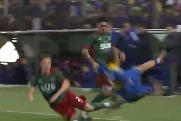 Zeballos recibió una durísima patada en el Boca-Agropecuario.