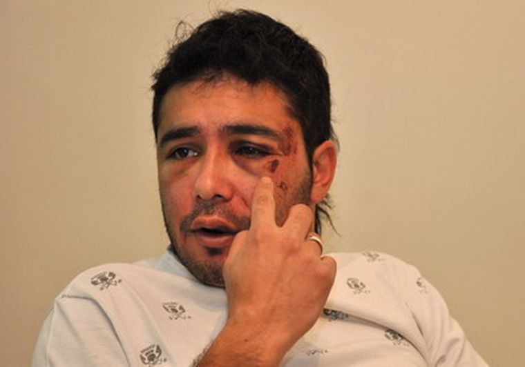 Para determinar la gravedad de las lesiones debe hacerse una tomografía. Foto: Pachy Reynoso / MDZ