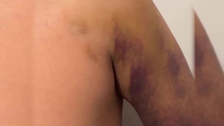 El comunicador relató los detalles de su infortunado accidente en redes sociales.