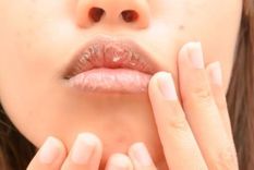 Ahora, preparar tu propio bálsamo hidratante está al alcance de tu mano con esta receta Foto: Shutterstock