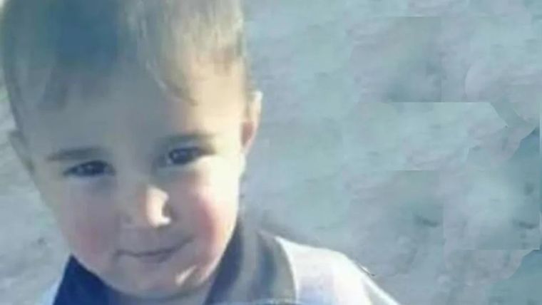 Tobías tenía quemaduras en su cuerpo de vieja data