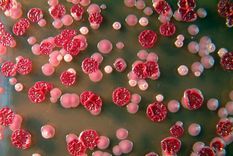 Melioidosis. Foto: joya.life