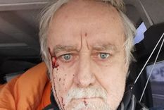 brutal agresion contra un periodista suizo en ucrania