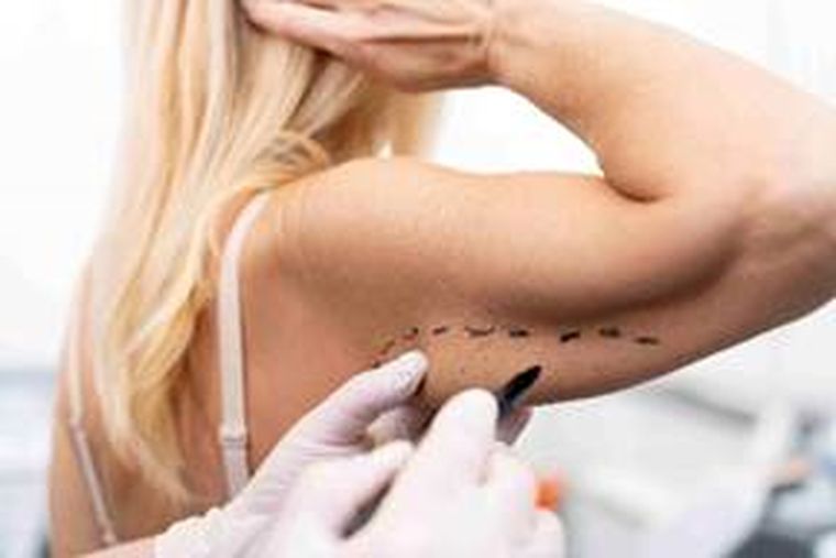 No todo brazo que incomoda necesita una cirugía. No todo brazo que incomoda necesita una cirugía.