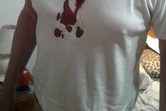 policias agredieron a un dirigente radical por violar la cuarentena