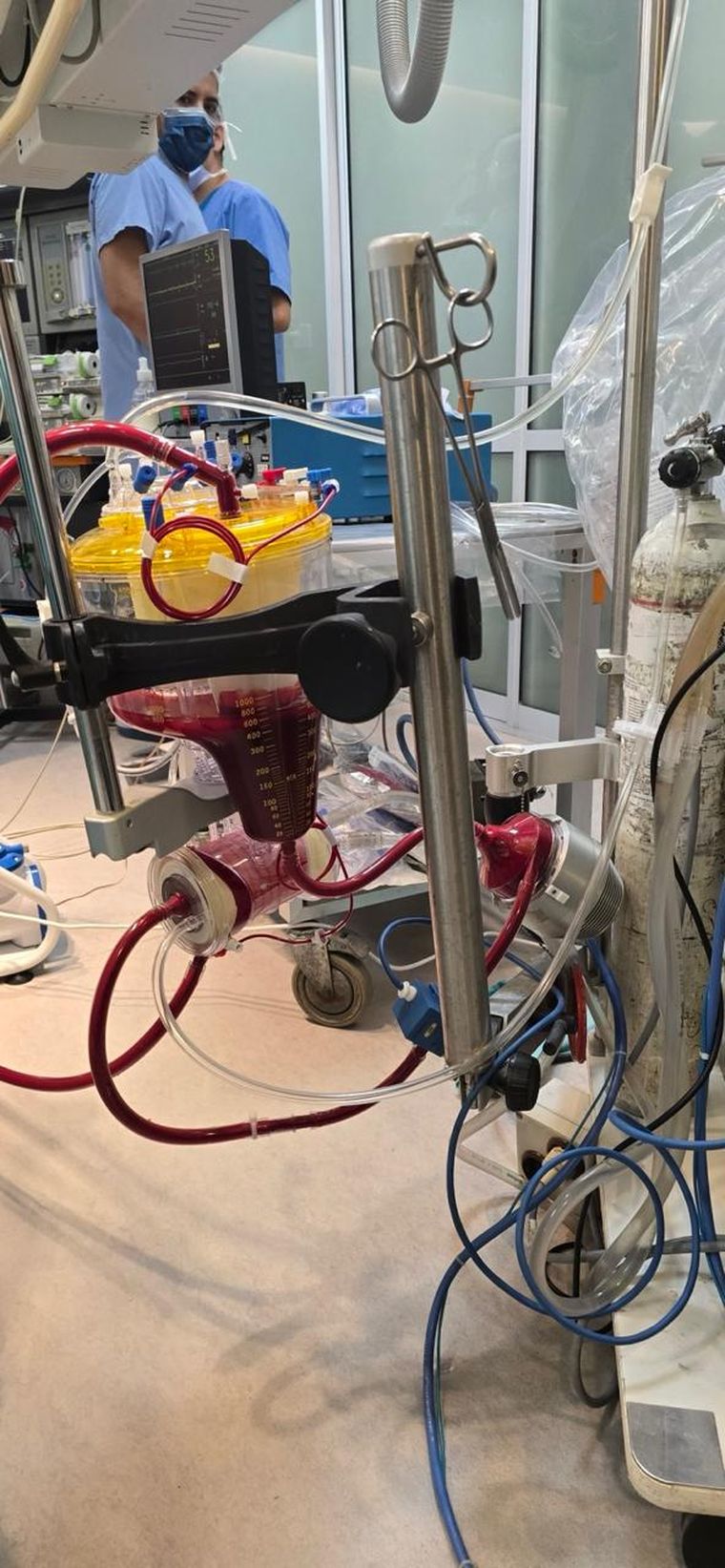 La cirugía se realizó este martes en el Hospital Italiano de Mendoza. 