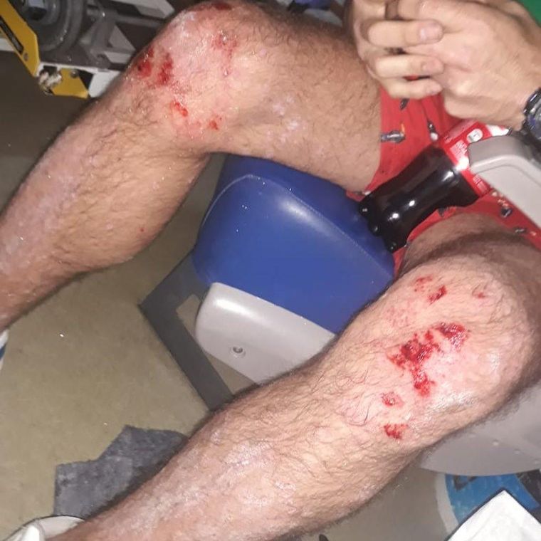 Brian sufrió lastimaduras tras el ataque