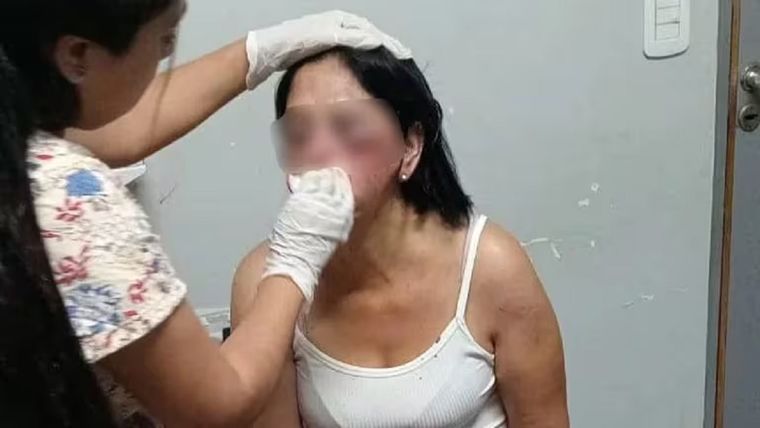 La víctima del brutal ataque Foto: Redes sociales