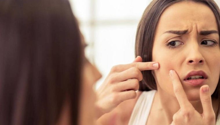 ¿Qué hacer cuando aparecen puntos negros? (Shutterstock)