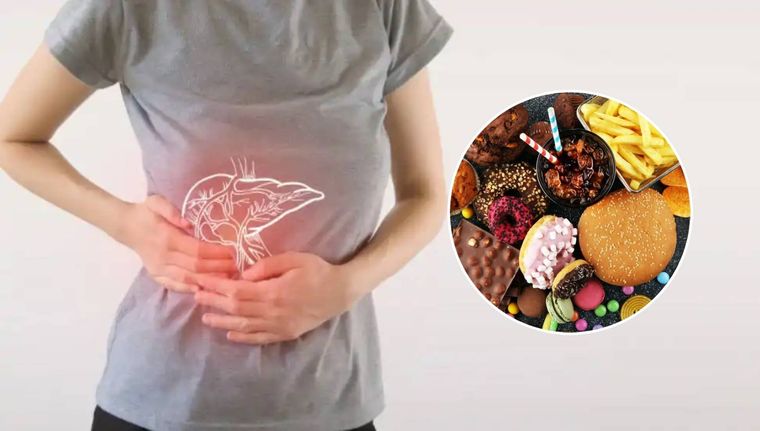 Cómo cuidar tu hígado graso de diferentes alimentos.